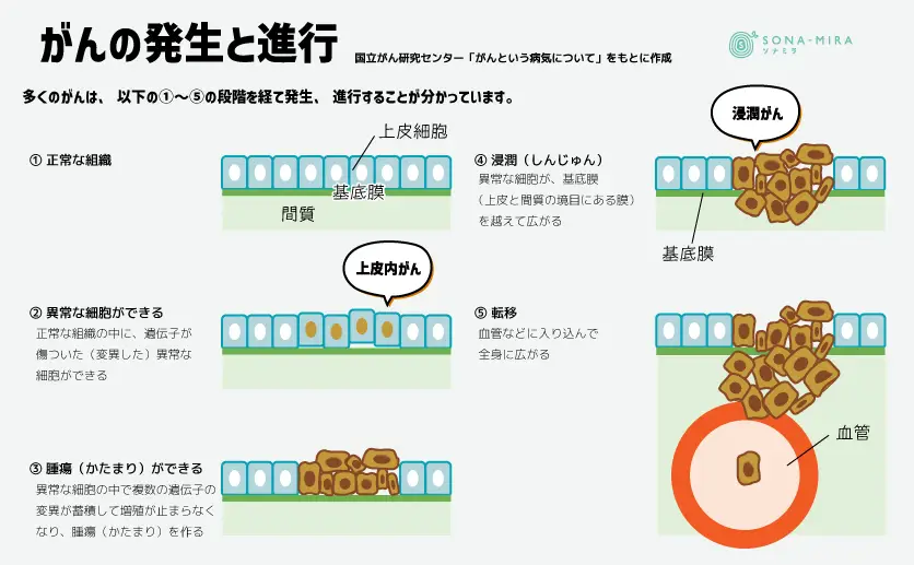 がんの発生と進行