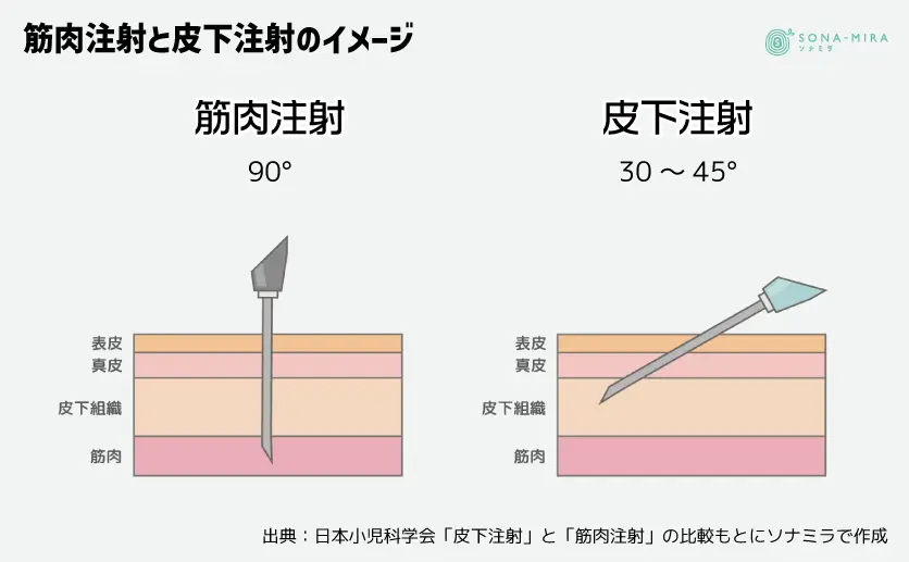 筋肉注射と皮下注射の違いのイメージ